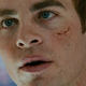 Image for article titled Blame Time Travel For Kirk's Scarred Psyche